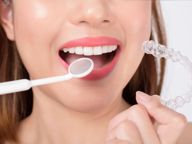 benefícios do invisalign com Dra. Fernanda Sallum em Uberaba